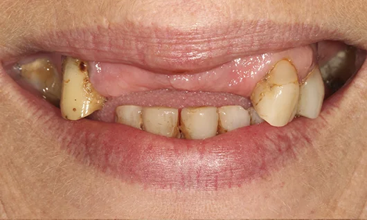 Casos de sucesso Dentes 12h - antes
